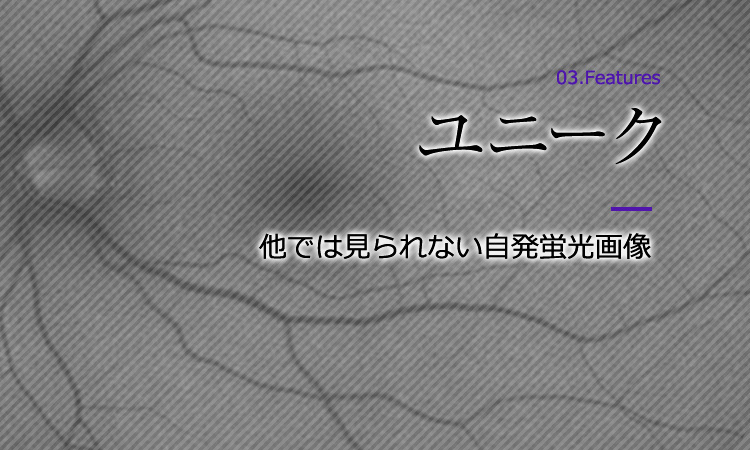 特徴3：ユニーク　他では見られない自発蛍光画像