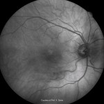 インフラレッド インフラレッド