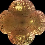 モザイク画像 モザイク画像